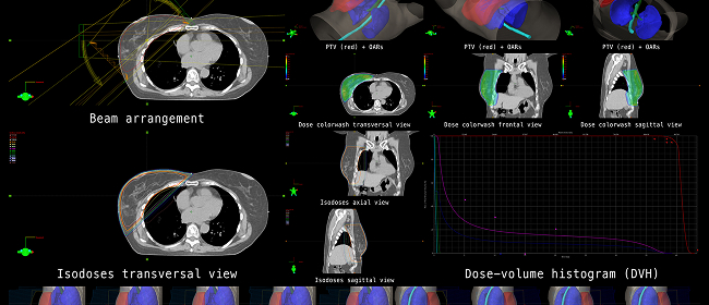 service-img-5 3d Conformal Radiation Scans